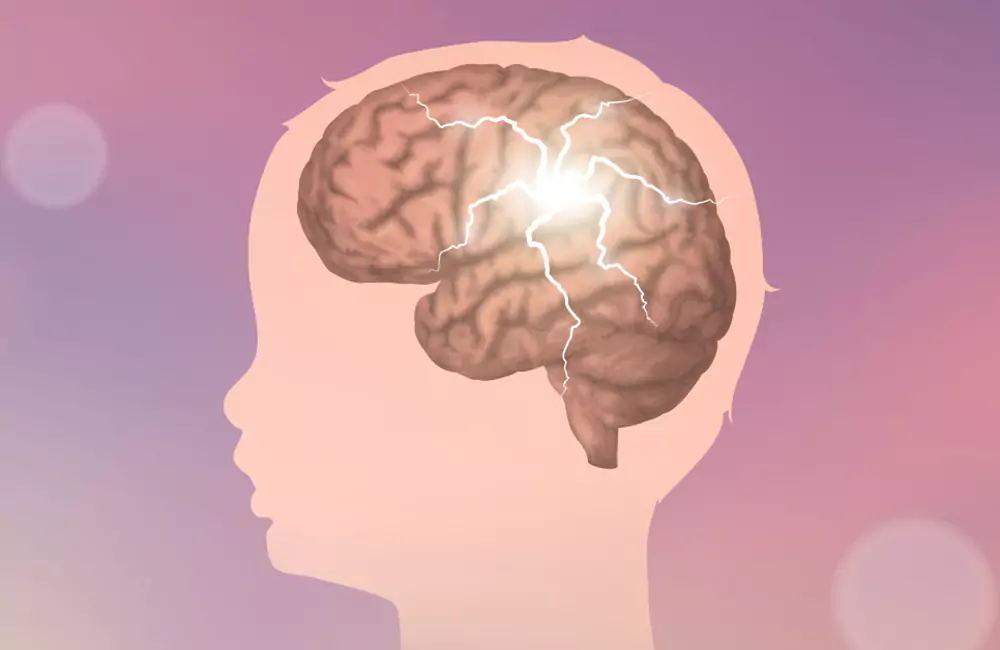 Epilepsy in Kids